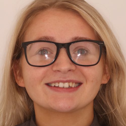 6 month braces and dental bonding at 3Dental - before